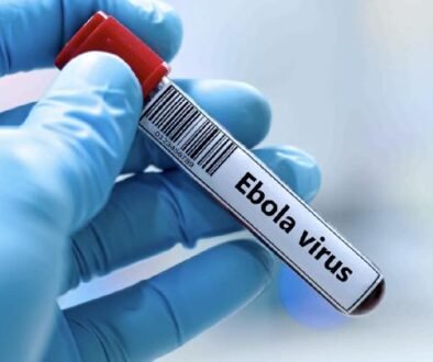 ebola-virus