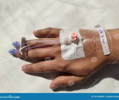 cannulation-venous-catheter-vein-human-hand-blood-infusion-sample-collection-cannula-right-arm-indian-man-197526959